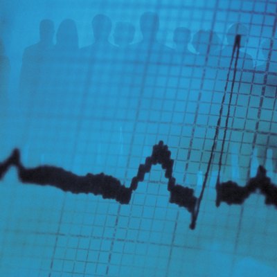 Silhouette of businesspeople on ekg printout with heartbeat