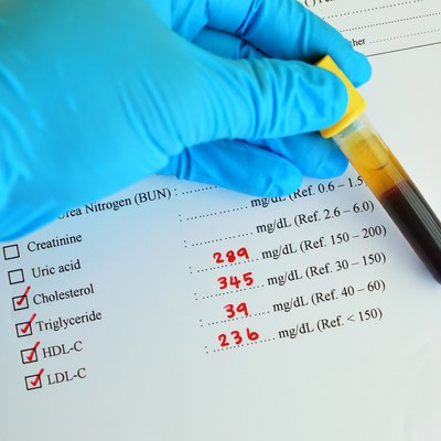 High lipid profile result