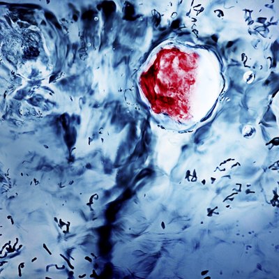 View of bacteria from microscope