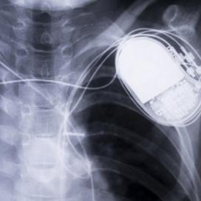 x-ray chestx-ray chest