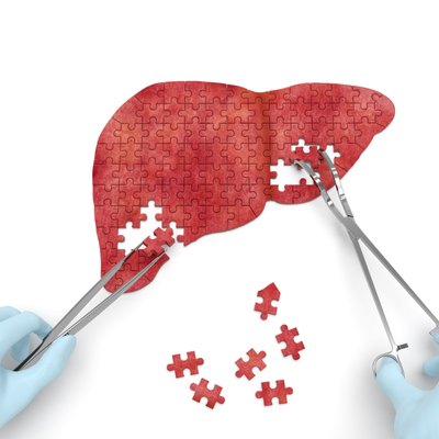 Liver operation