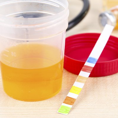 Check-up. Medical report and urine test strips