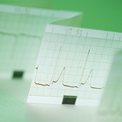 Printout of electrocardiogram