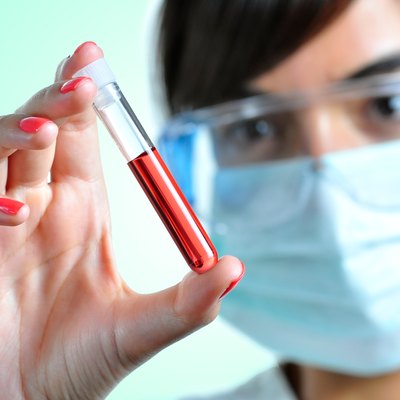 Blood Sample