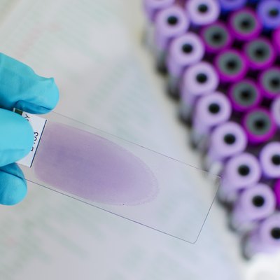 Wright stained blood film
