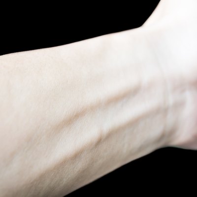 Left arm isolated on black