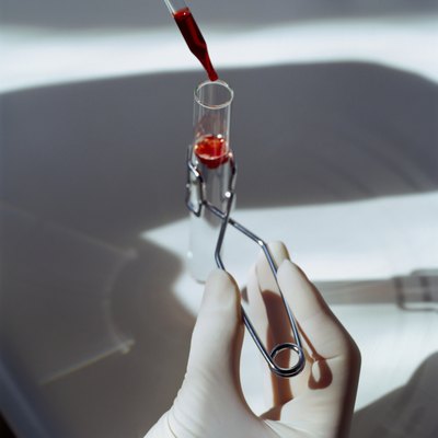 Hand with Test Tube and Dropper