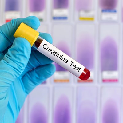 Creatinine test