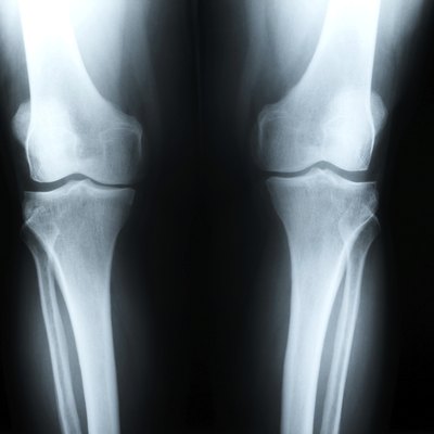 x-ray