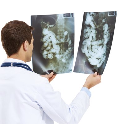 Deciding on a course of action for treatment