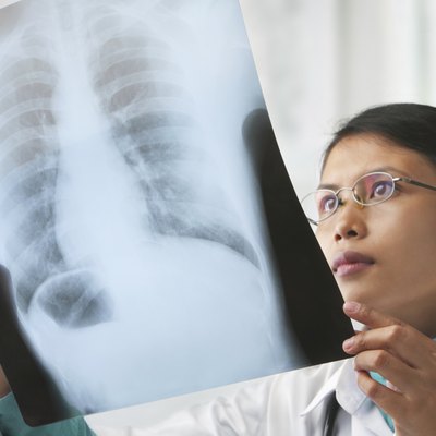 Female doctor checking xray image