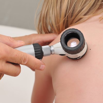 Dermatologist examines child patient birthmark with dermatoscope