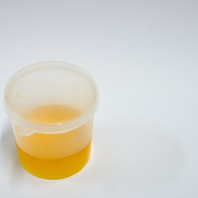 urine