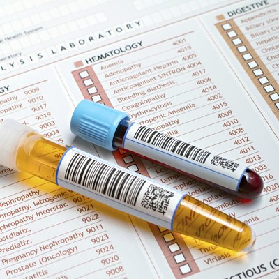medical report with tubes of blood and urine