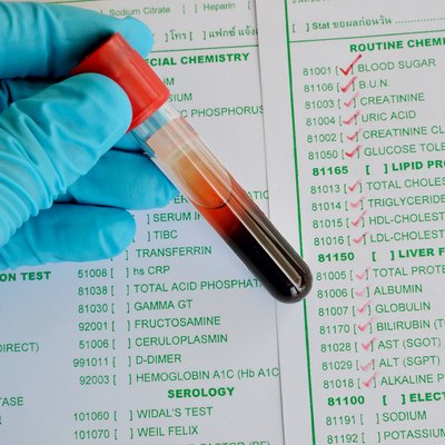 Blood chemistry