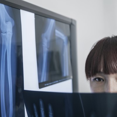 Female doctor looking at x-ray of human bones