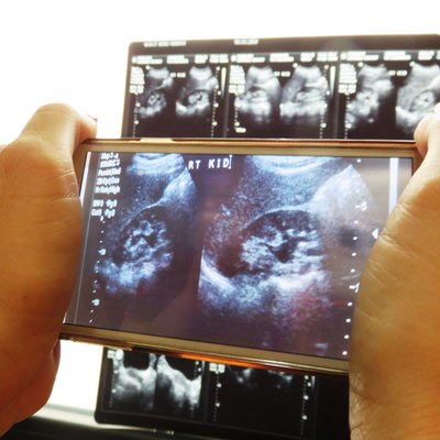 Analysis of findings