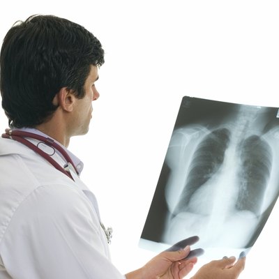 Oncologist with chest x-ray