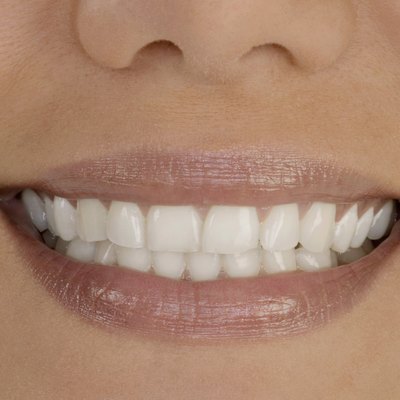 Extreme close-up of young woman's smile