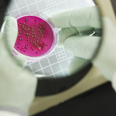 Scientist analyzing bacterial colonies