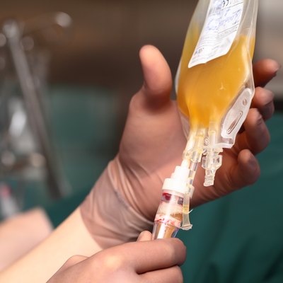 Transfusion of human plasma.