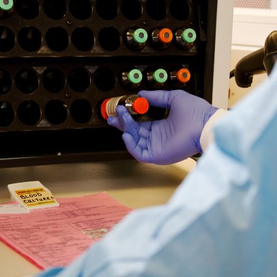 Blood culture incubation vials