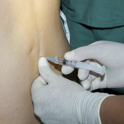 Spinal Anesthetic