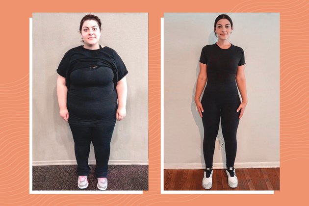 Tina Minasyan's gastric sleeve before and after photos