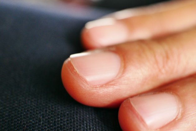 vitamin-deficiencies-and-spots-on-finger-nails-livestrong