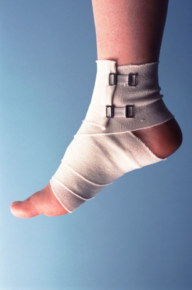How To Care For A Sprained Foot Livestrong
