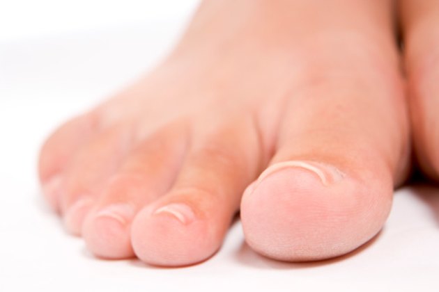 how-to-remove-a-toenail-livestrong