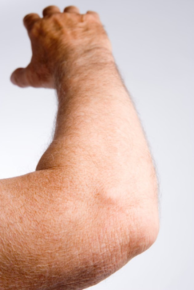 Causes Of Painful Dry Skin On The Elbows Livestrong