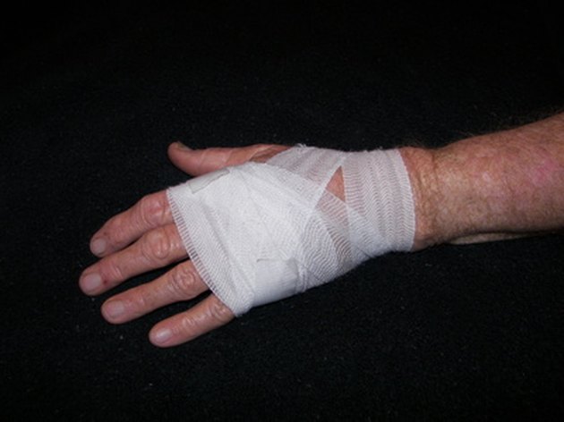 How to Wrap a Sprained Hand in an ACE Bandage | Livestrong.com