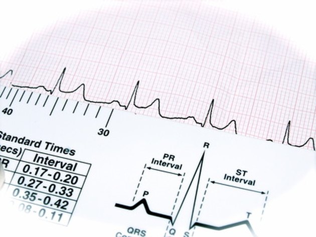 A cardiologist may be necessary