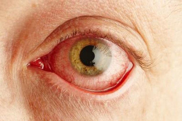 Pigmentation, the iris, your eye color
