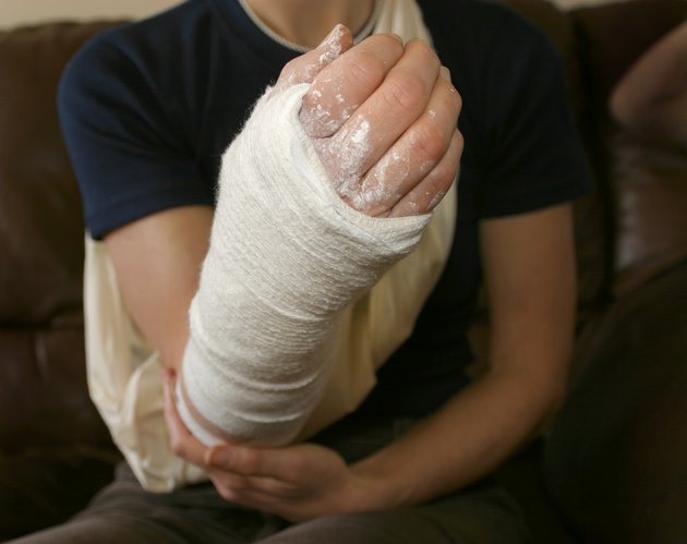 Broken arm in cast