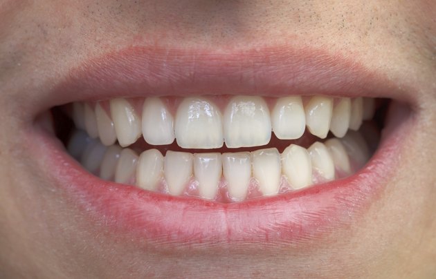 Mouth and teeth