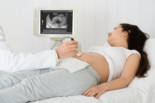Doctor Performing Ultrasound Scan On Expecting Woman