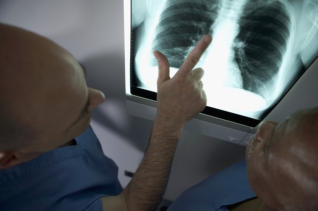 High angle view of two doctors looking at x-ray