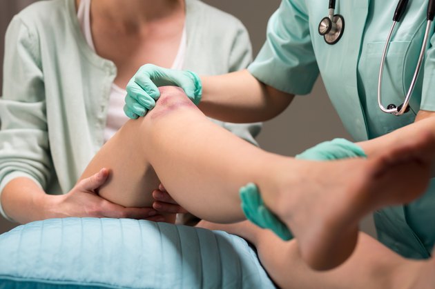 Woman with knee contusion