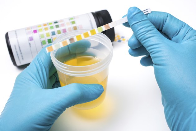 Urine test strips