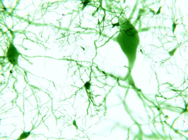 Pyramidal neurons