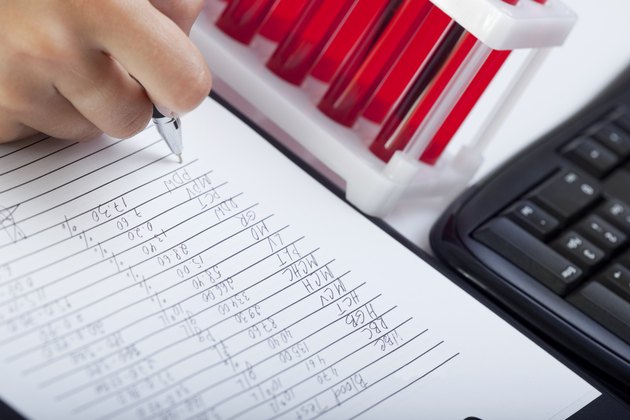 Doctor's medical notes and blood samples.