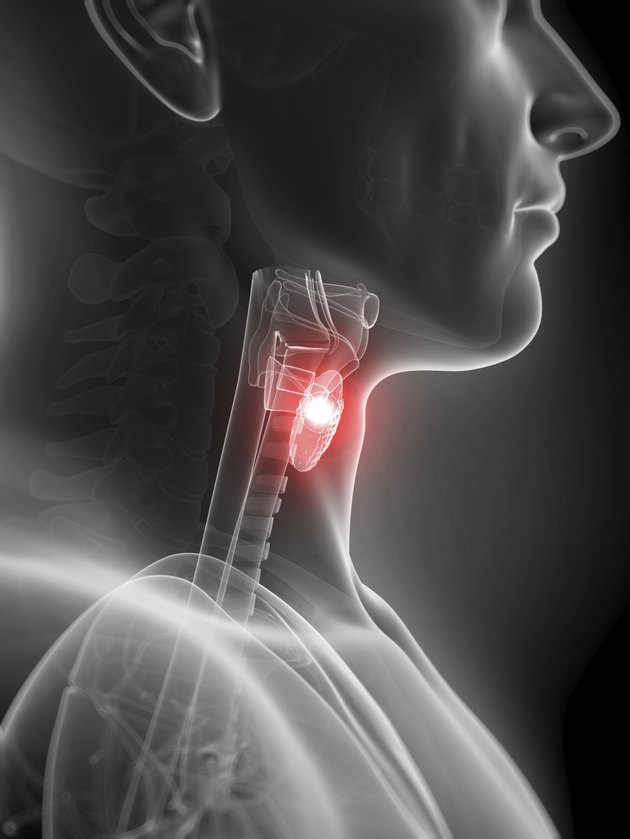 inflamed thyroid gland