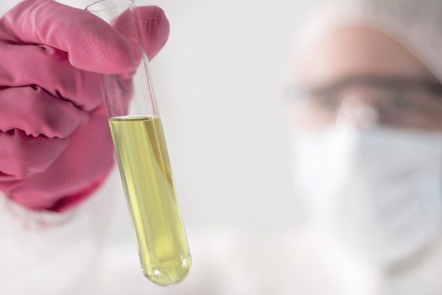 Urinalysis
