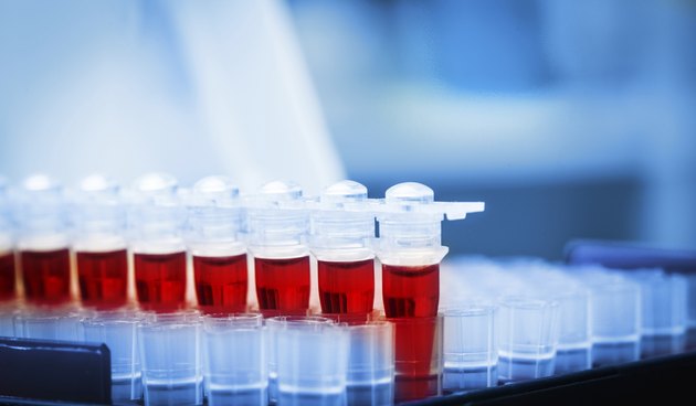 Blood samples