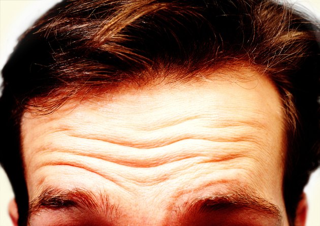 Man's Hairline