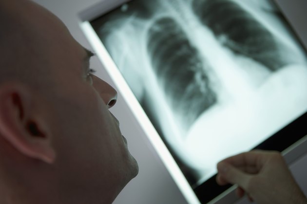 Lung Puncture Symptoms | Livestrong.com