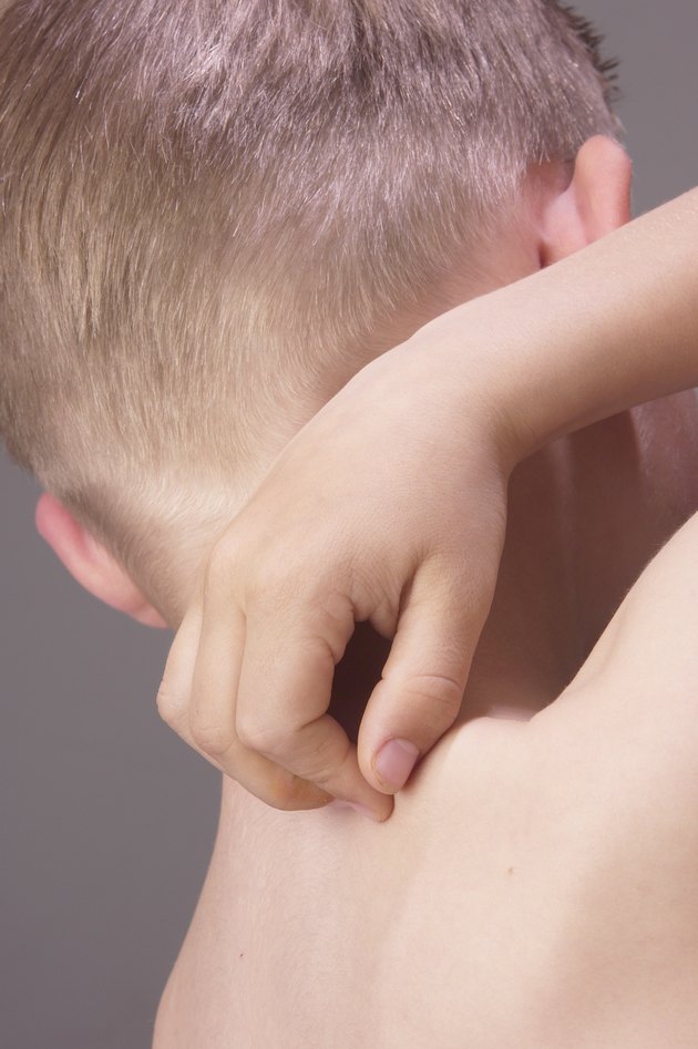 Boy scratching back