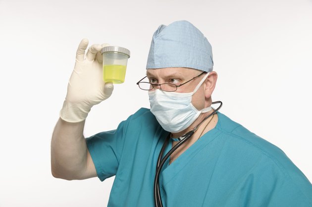 Doctor looking at specimen cup